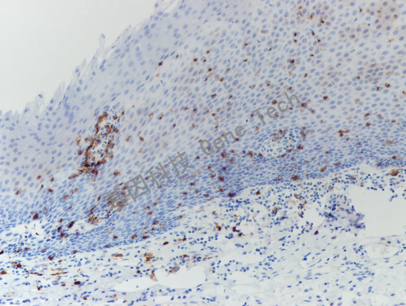 20200102-4 CD103 W10 扁桃体-6_副本.jpg