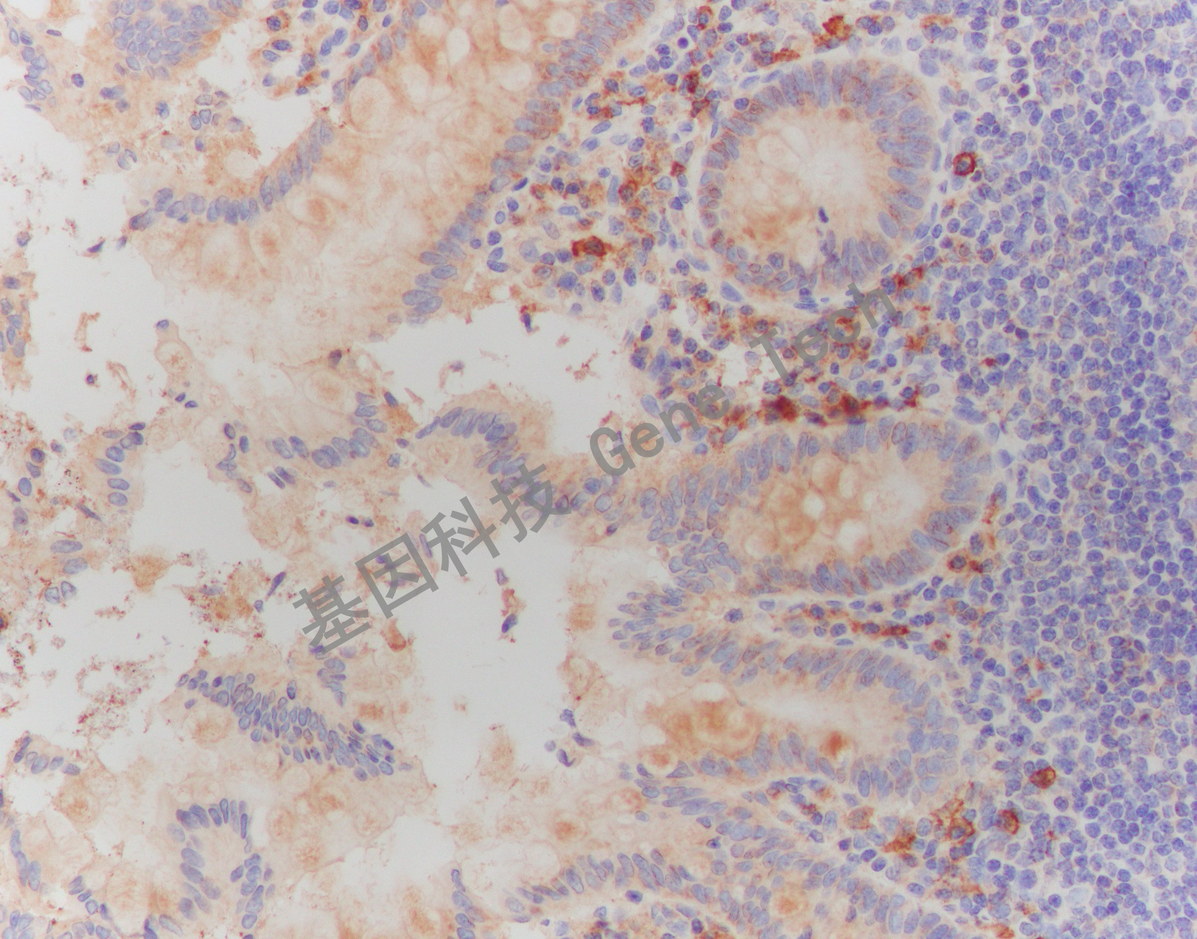 cd138-cd138