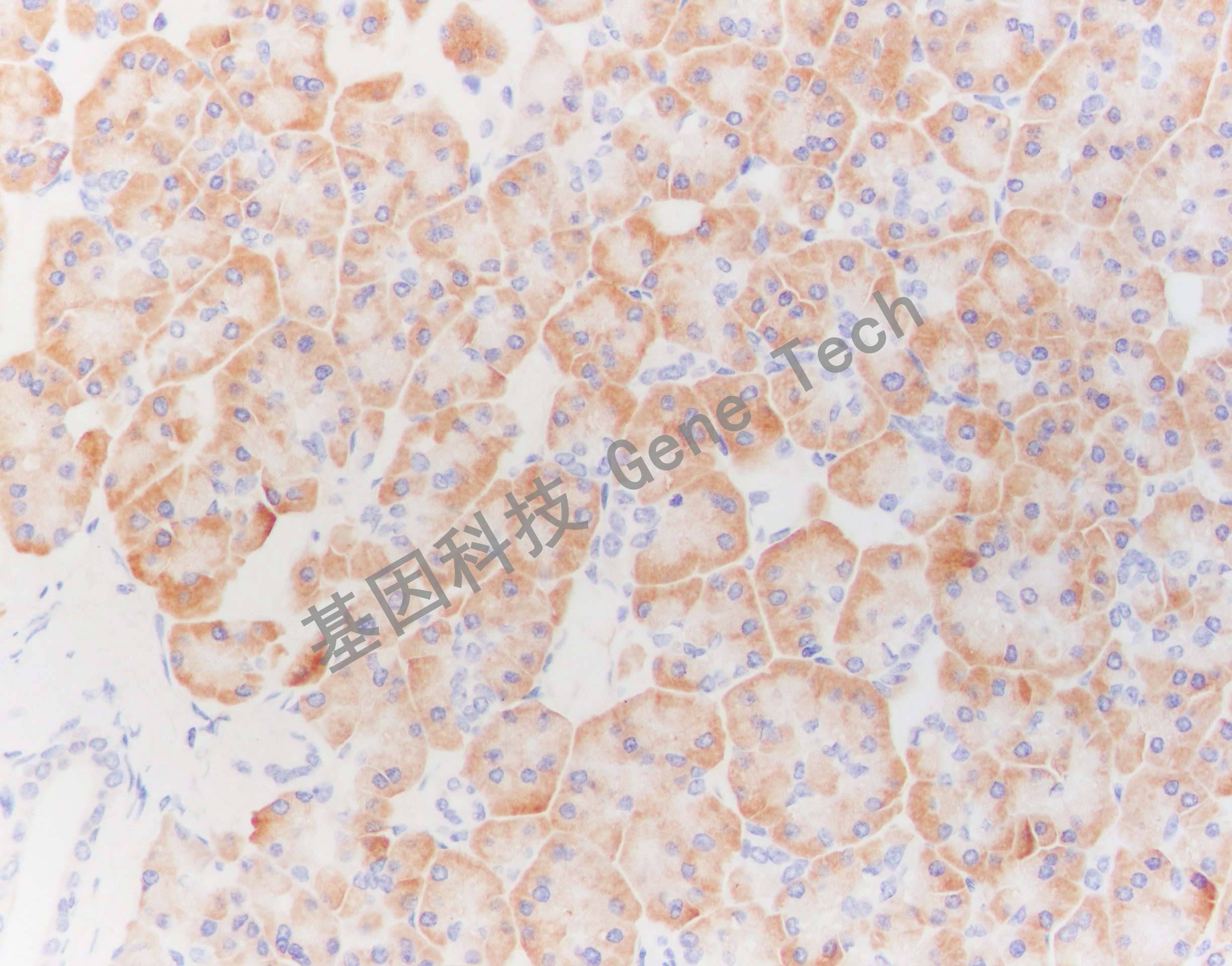cd138-cd138