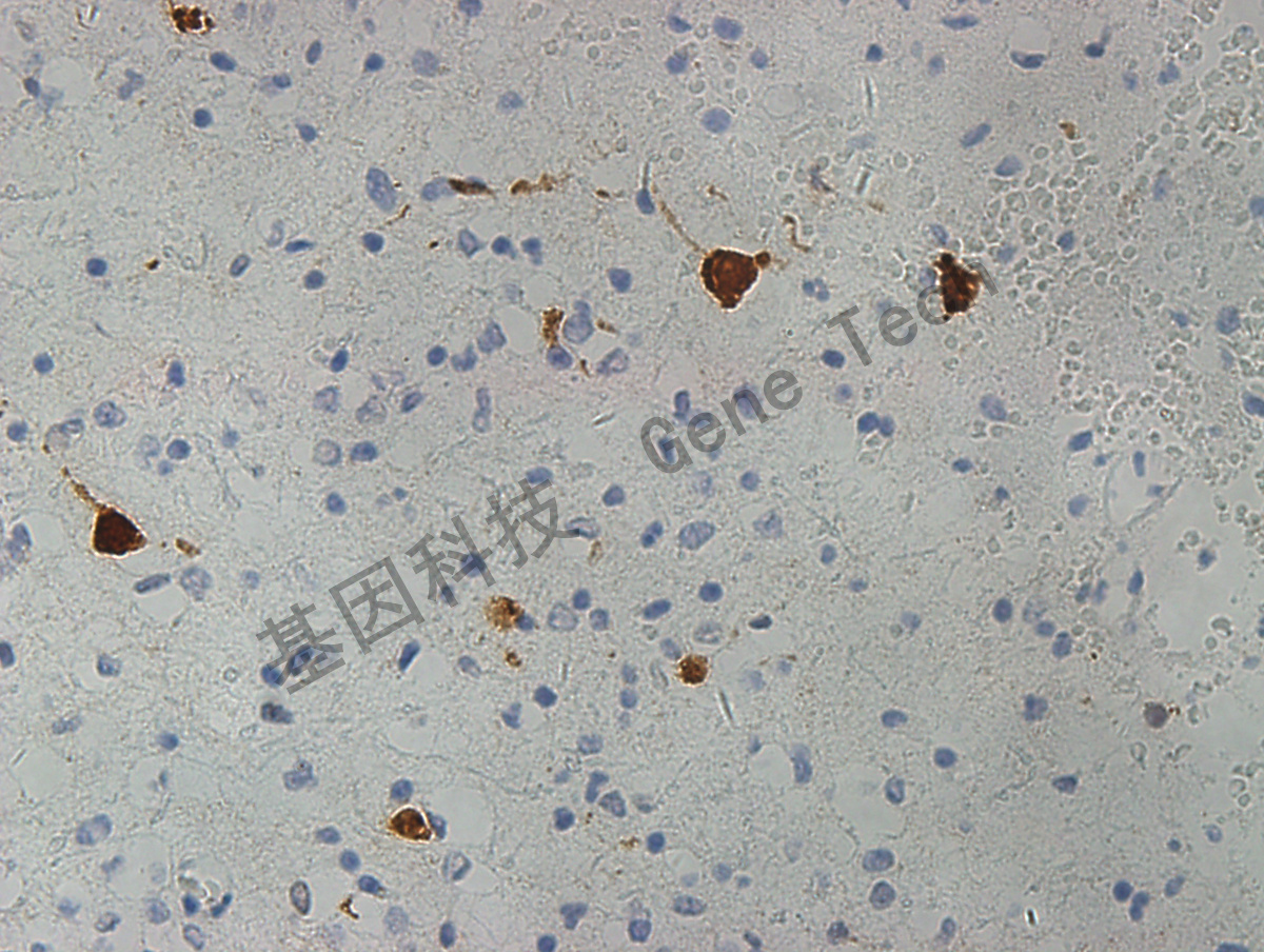 neun抗体试剂(免疫组织化学)单克隆鼠抗人神经元核抗原clone name:a60