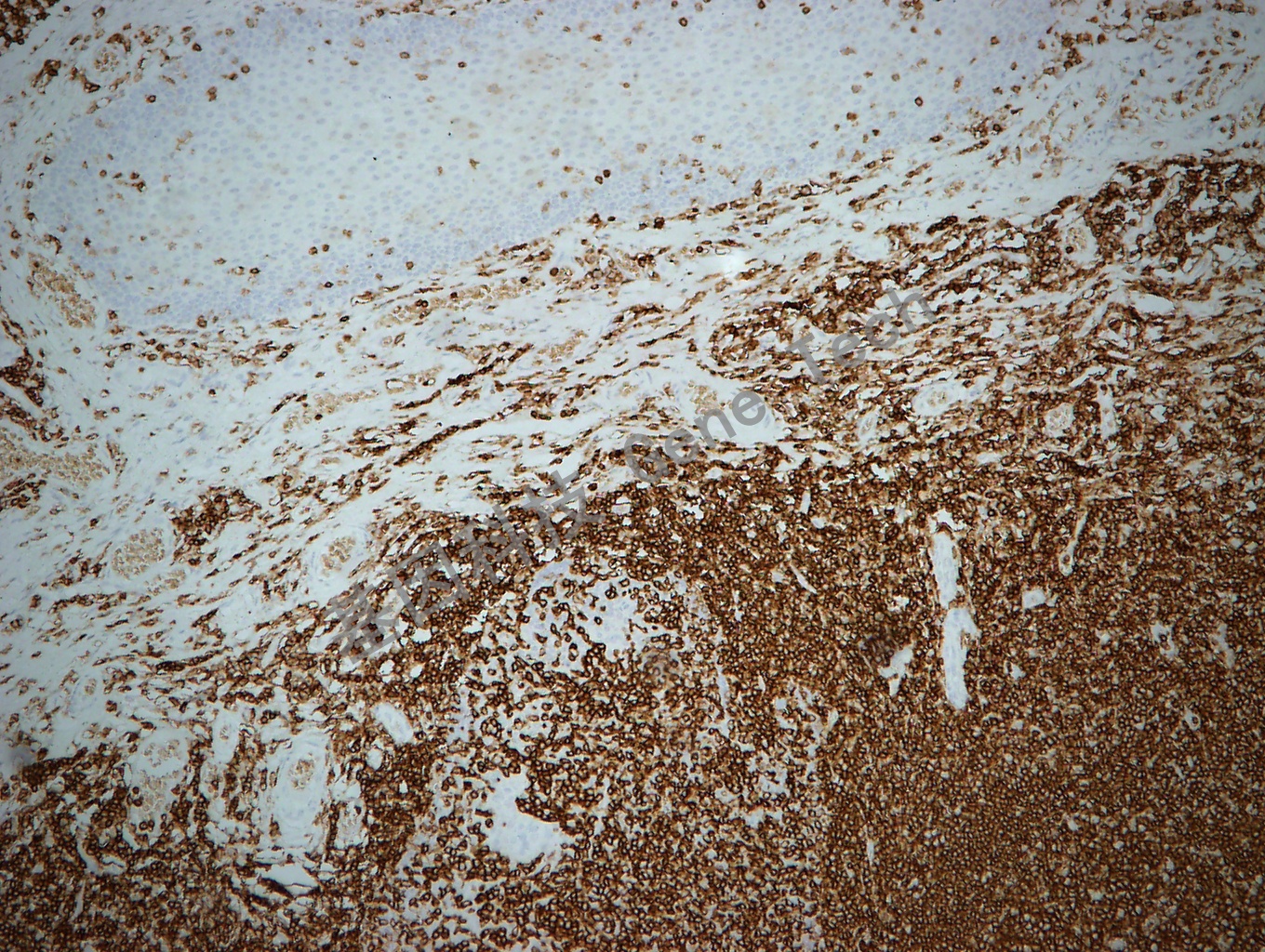 CD45RB GT2219 10X 扁桃体_副本.jpg