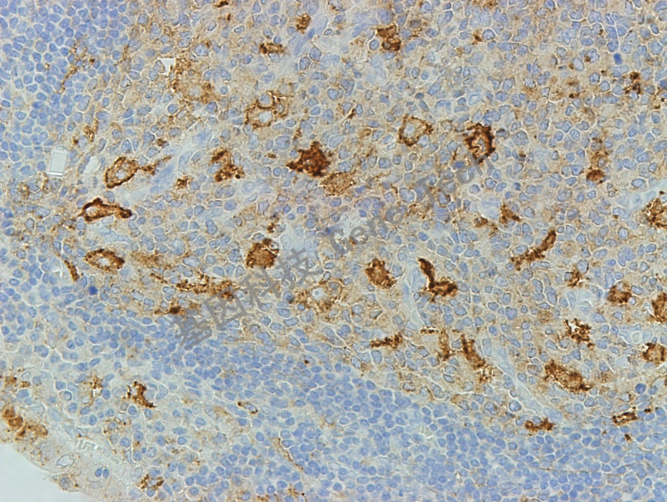 CD71 GT2143  阑尾40X_副本.jpg