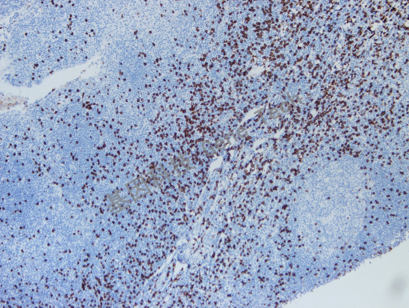 CD8 GT2112 扁桃体 10X    20190722-12_副本.jpg