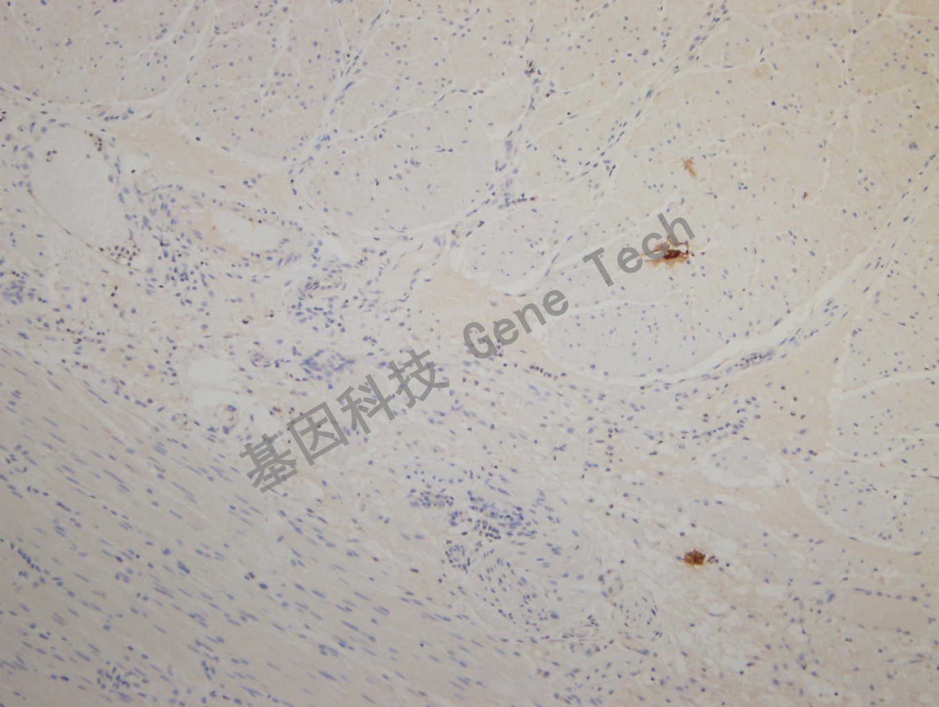 20180925-14 CKPAN-1 Esophagus2_副本.jpg