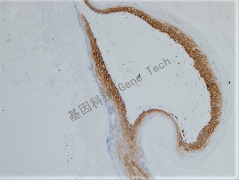 CK14 皮肤_副本.jpg