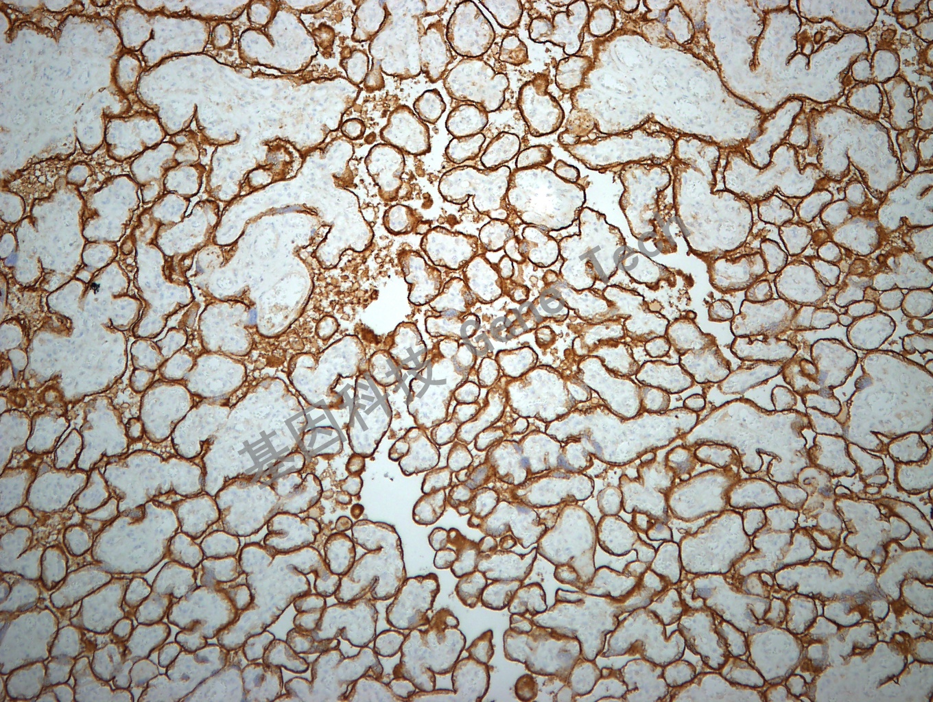 CD71 GT2143  胎盘 10X_副本.jpg