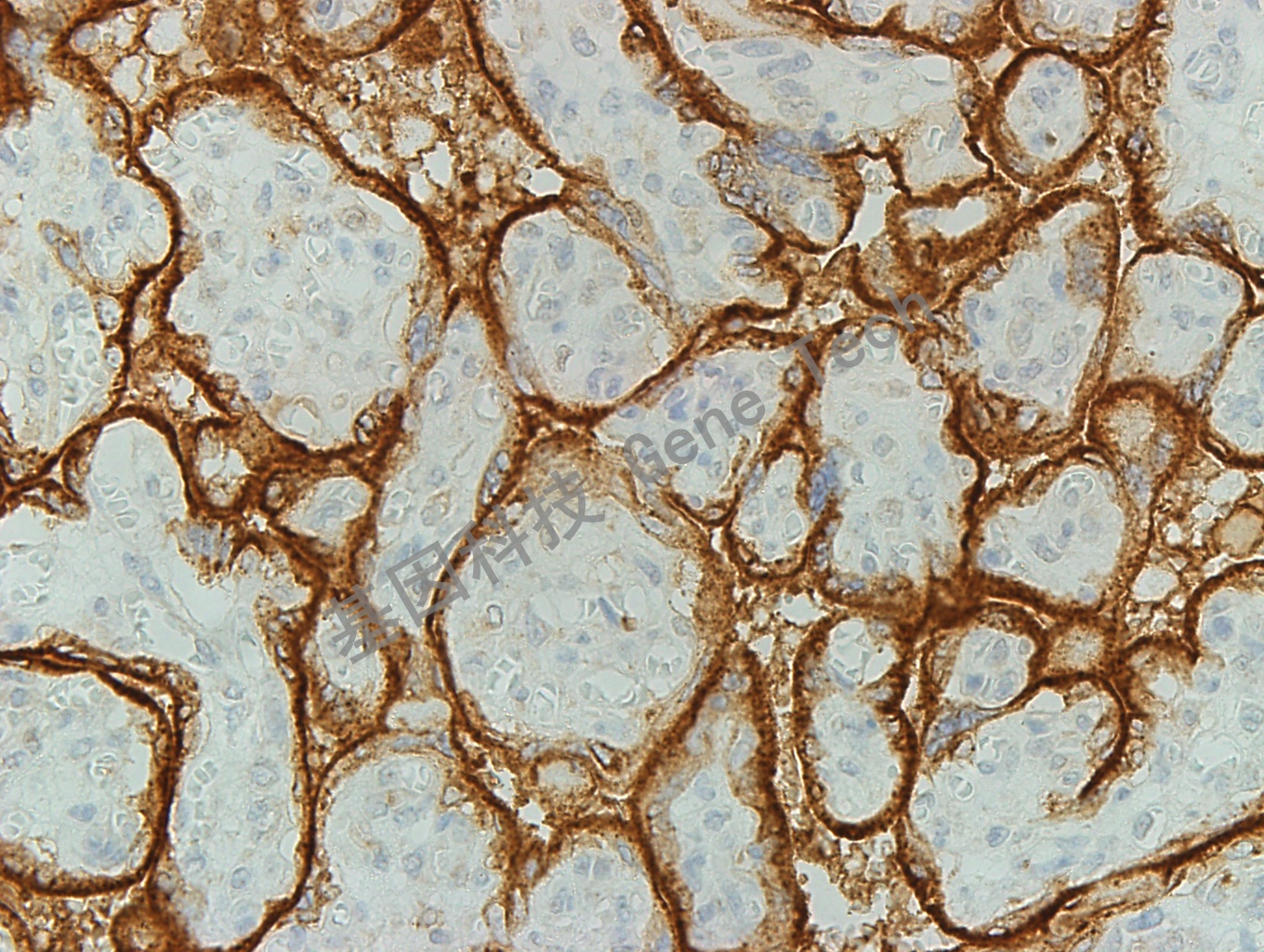 CD71 GT2143  胎盘 40X_副本.jpg