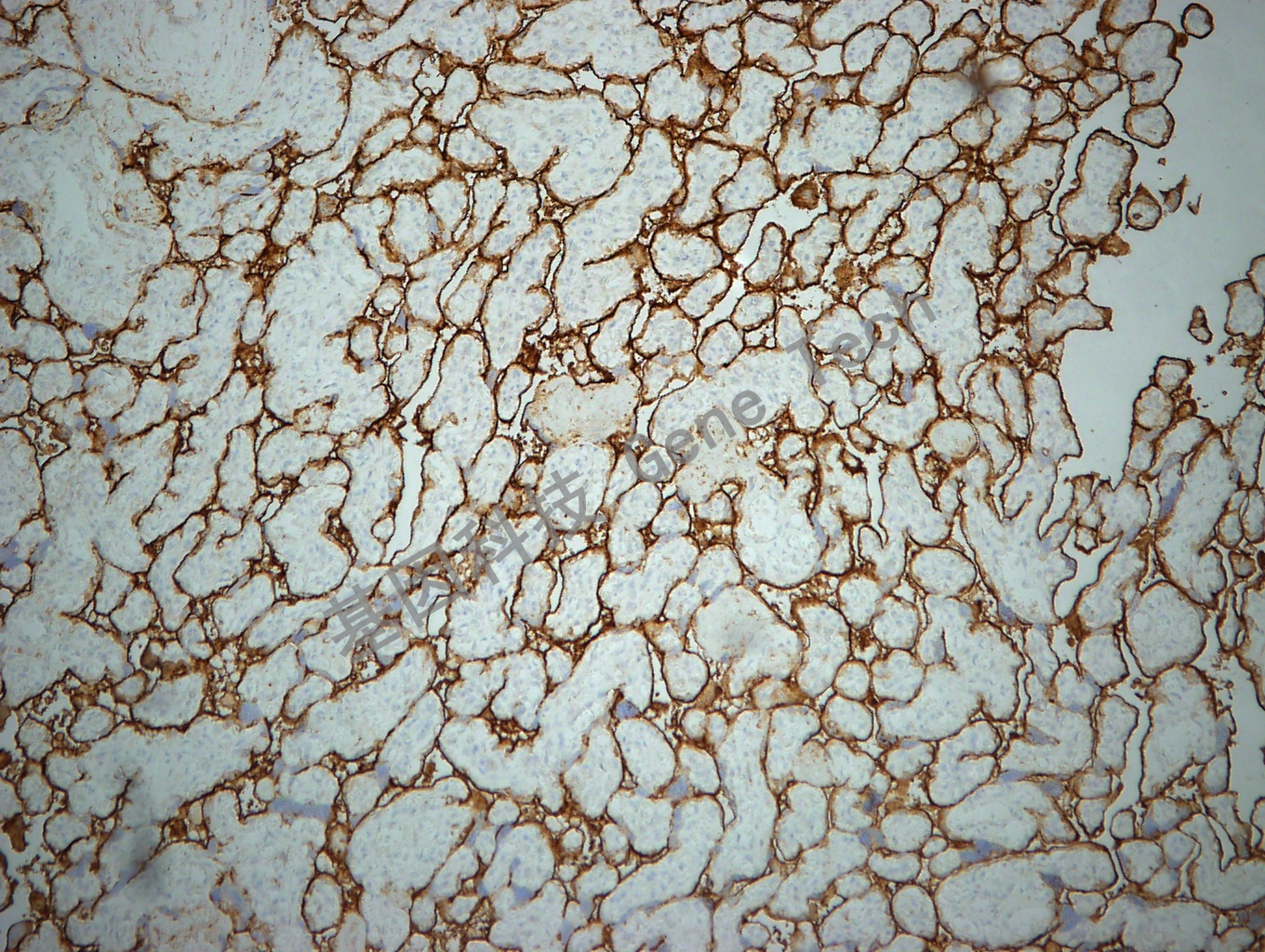 CD71 GT2143 胎盘 10X_副本.jpg