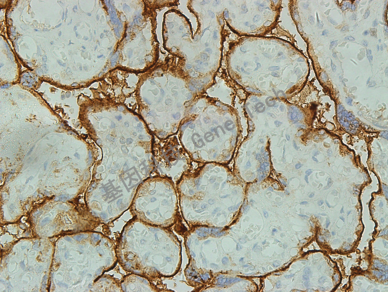 CD71 GT2143 胎盘 40X_副本.jpg