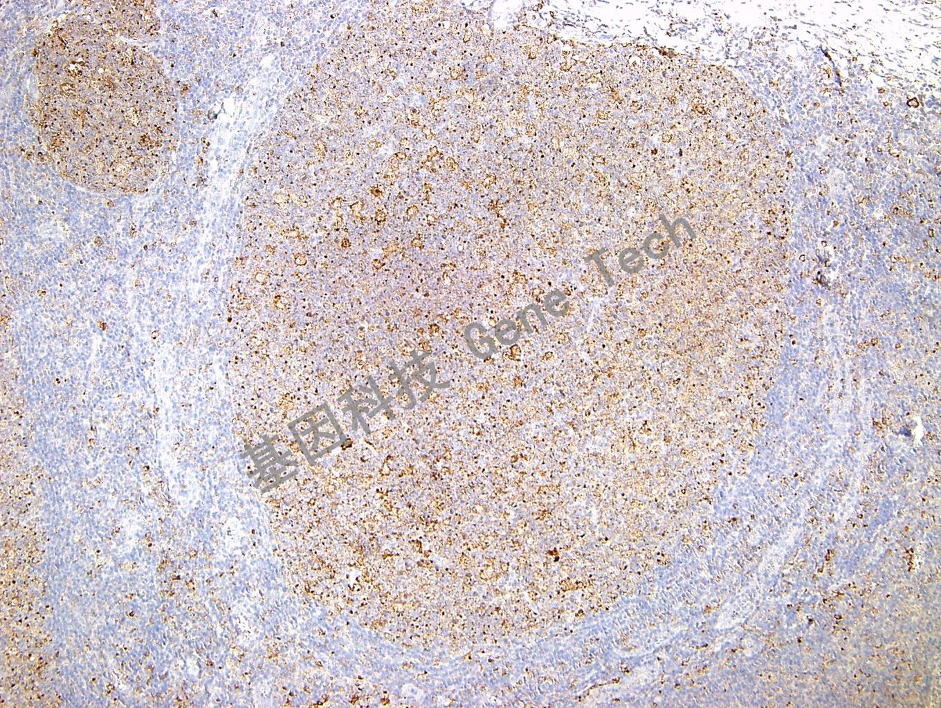 CD71 GT2143 10X 扁桃体_副本.jpg