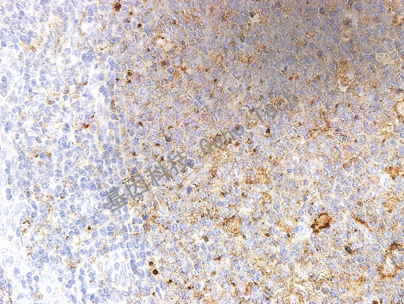 CD71 GT2143 扁桃体_副本.jpg