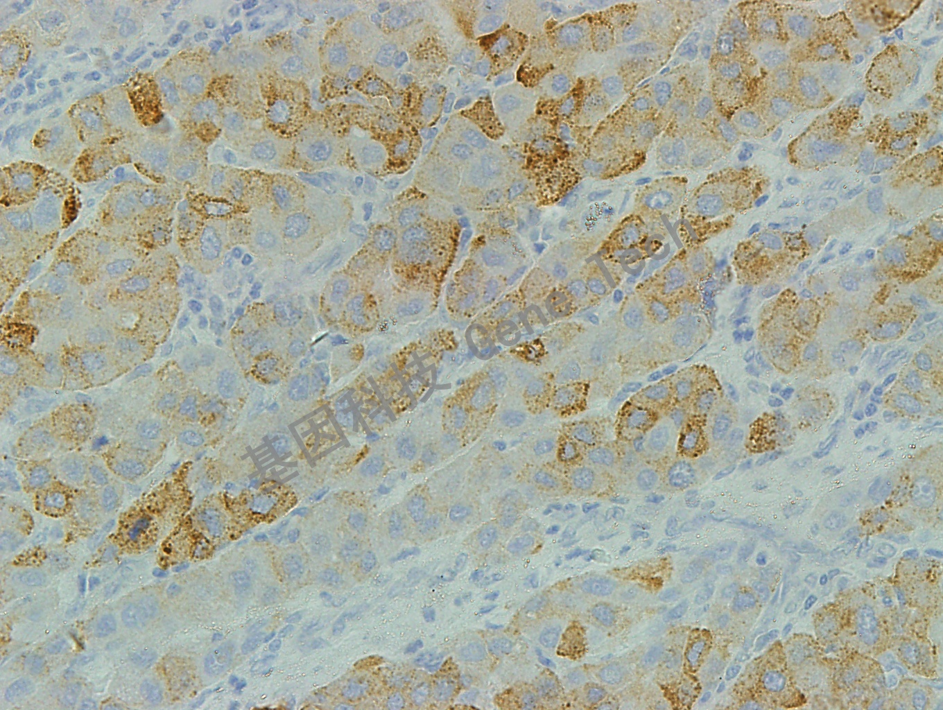 CD71 GT2143 肝 40X_副本.jpg