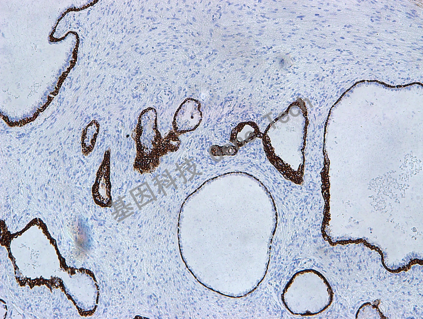 CKH GM0634  前列腺增生组织_副本.jpg
