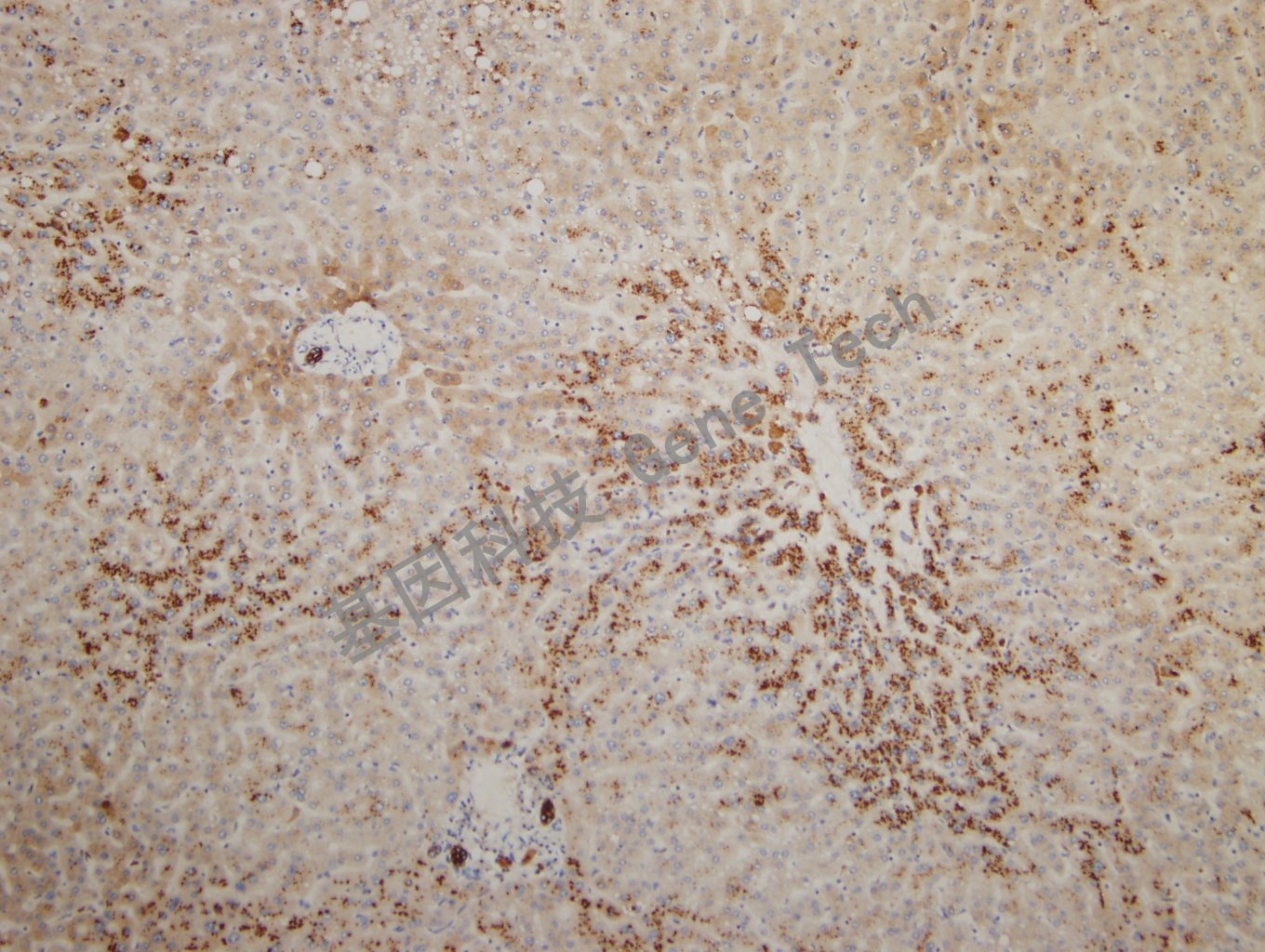 20180925-14 CKPAN-2 Liver_副本.jpg