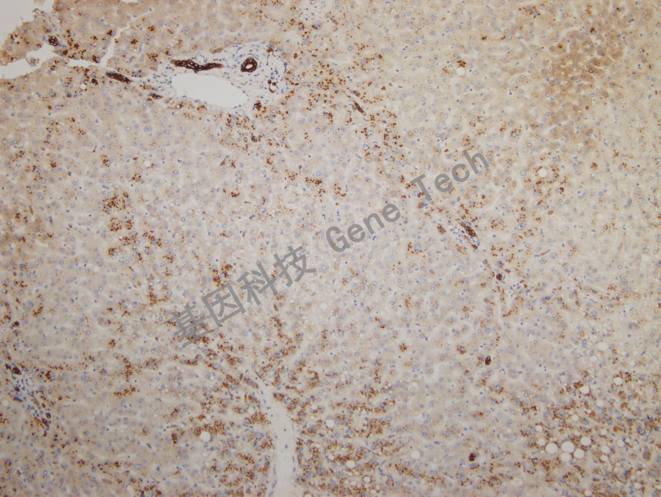 20180925-14 CKPAN-2 Liver2_副本.jpg