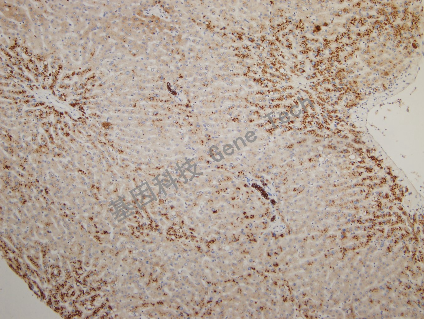 20180925-14 CKPAN-2 Liver3_副本.jpg