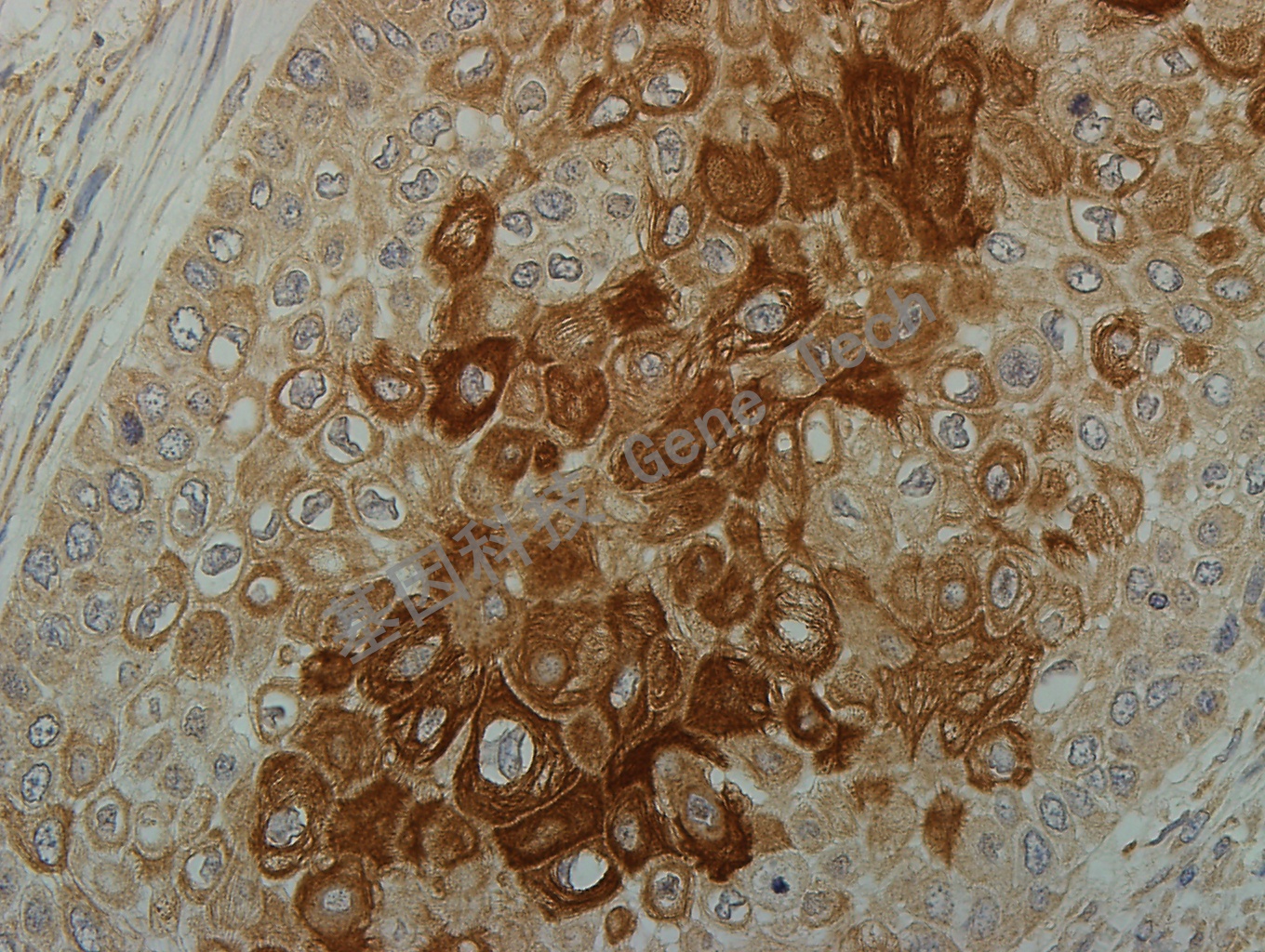 CK16 GT2228  40X 食管_副本.jpg