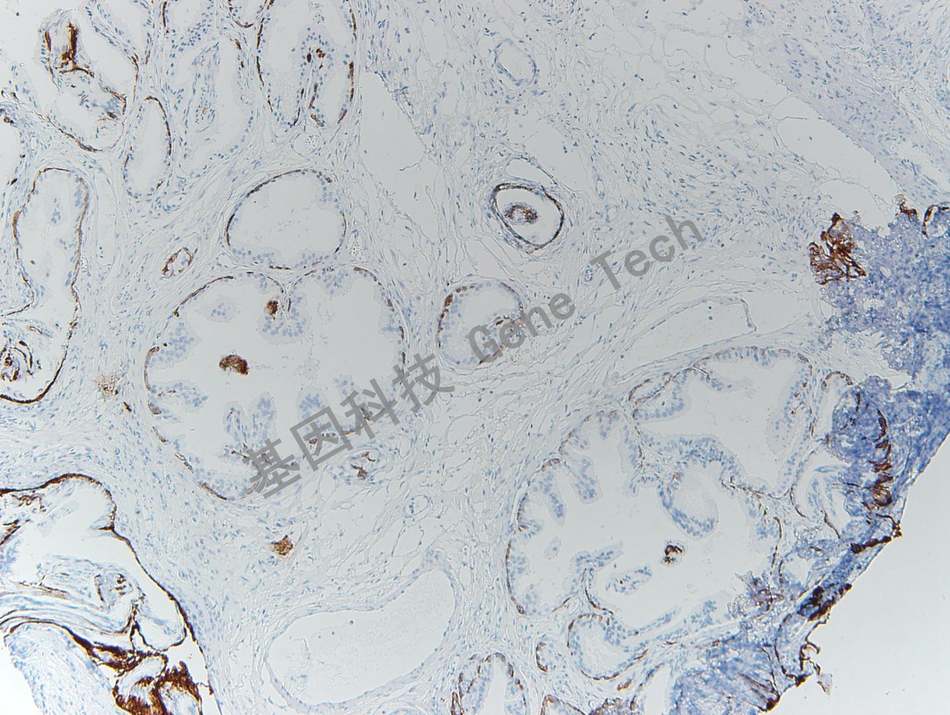 20200416-10 CK5 P63-T6 正常前列腺_副本.jpg