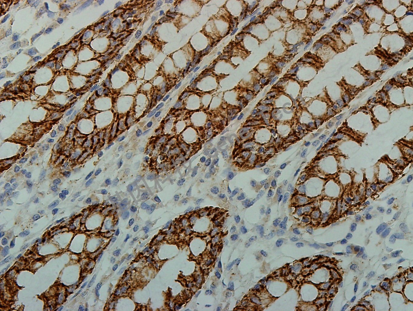 claudin GT2211 40X 结肠_副本.jpg