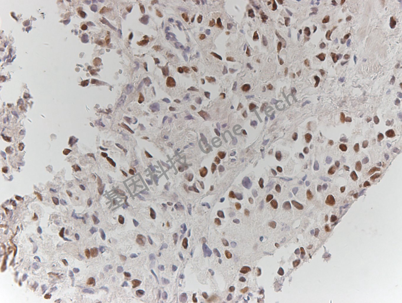 c-myc GT2206 前列腺癌_副本.jpg