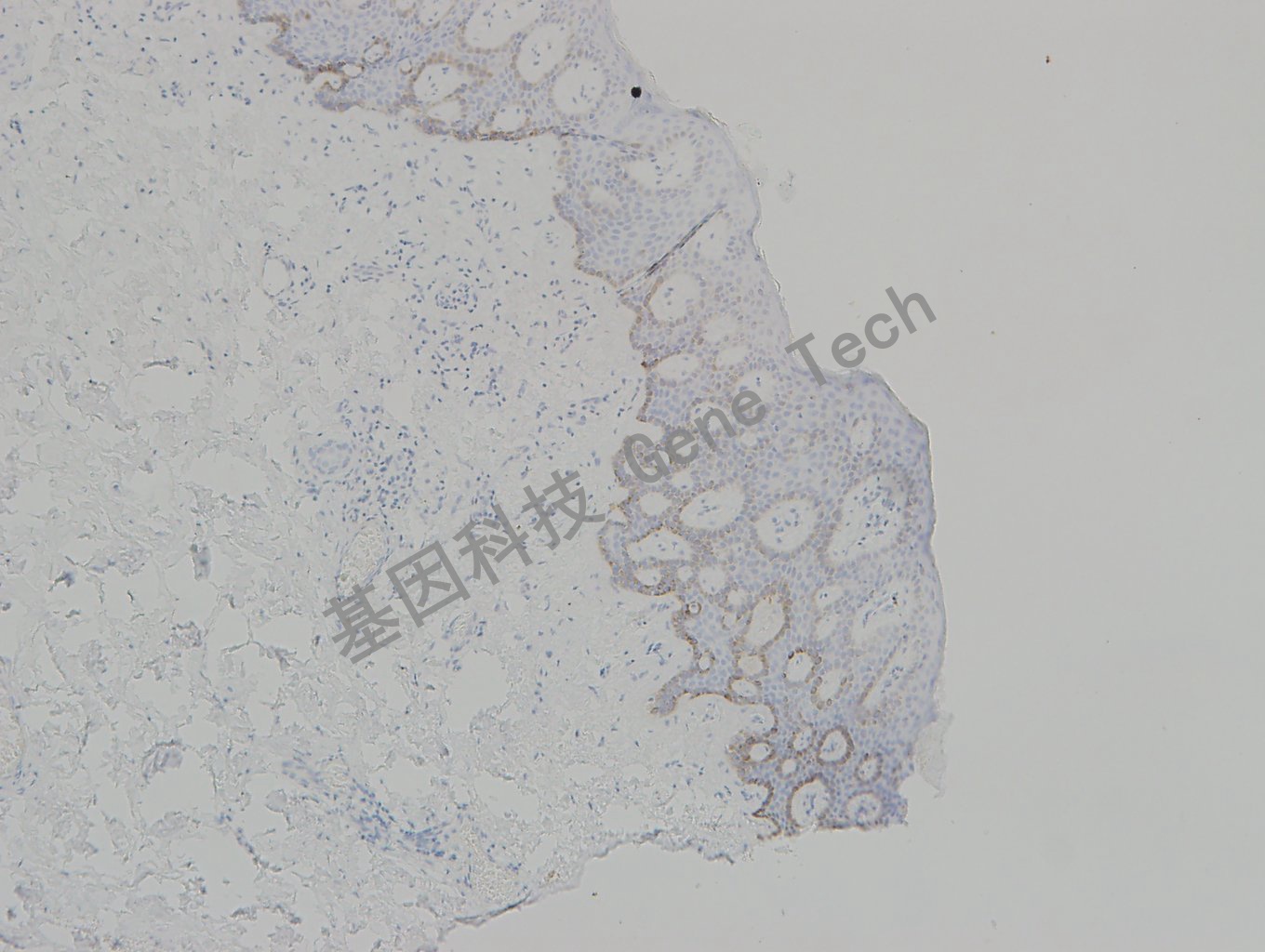 20190315-13 collagen IV BE7 皮肤-3_副本.jpg