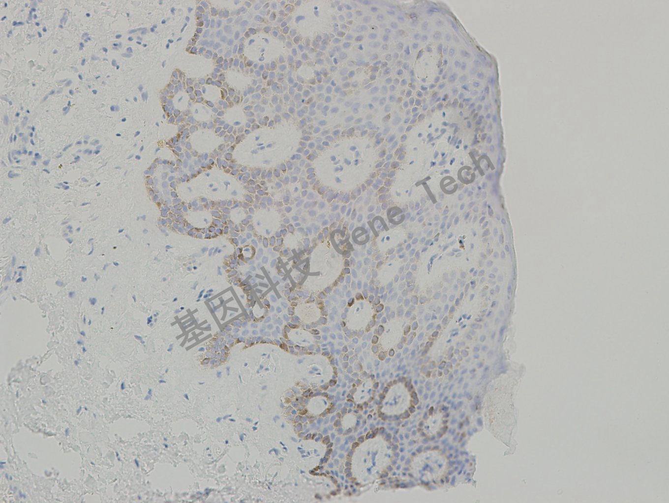 20190315-13 collagen IV BE7 皮肤-4_副本.jpg