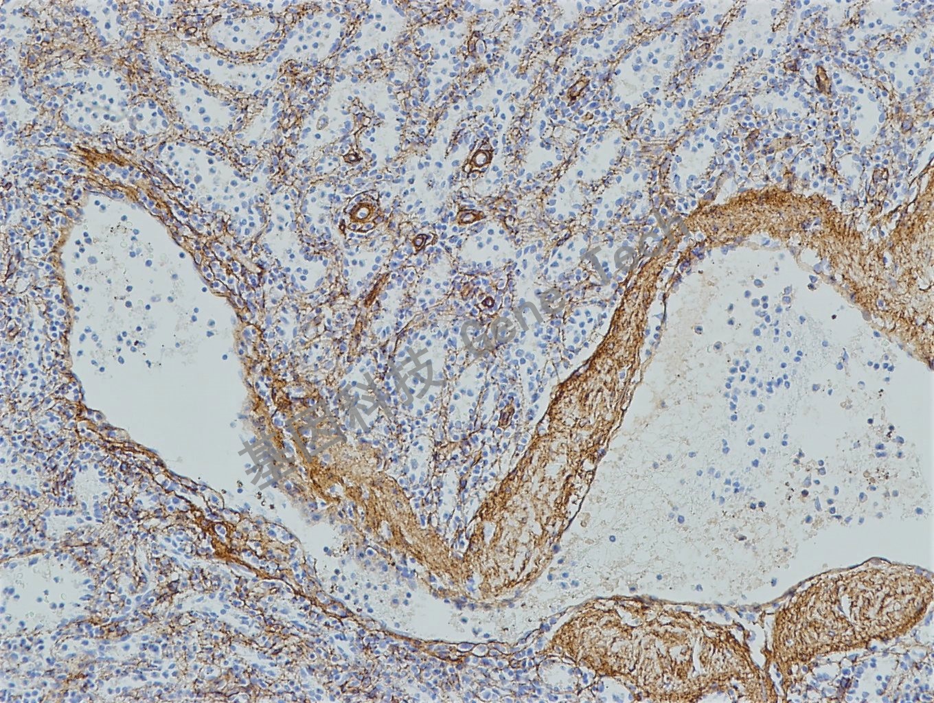 collagen IV 脾脏_副本.jpg