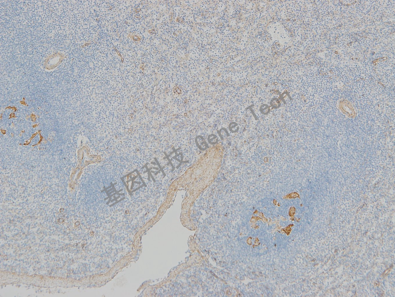 20190315-14 collagen IV BF6 脾脏-1_副本.jpg