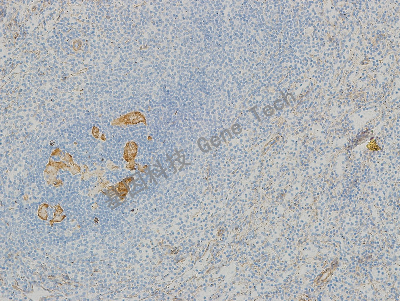 20190315-14 collagen IV BF6 脾脏-2_副本.jpg