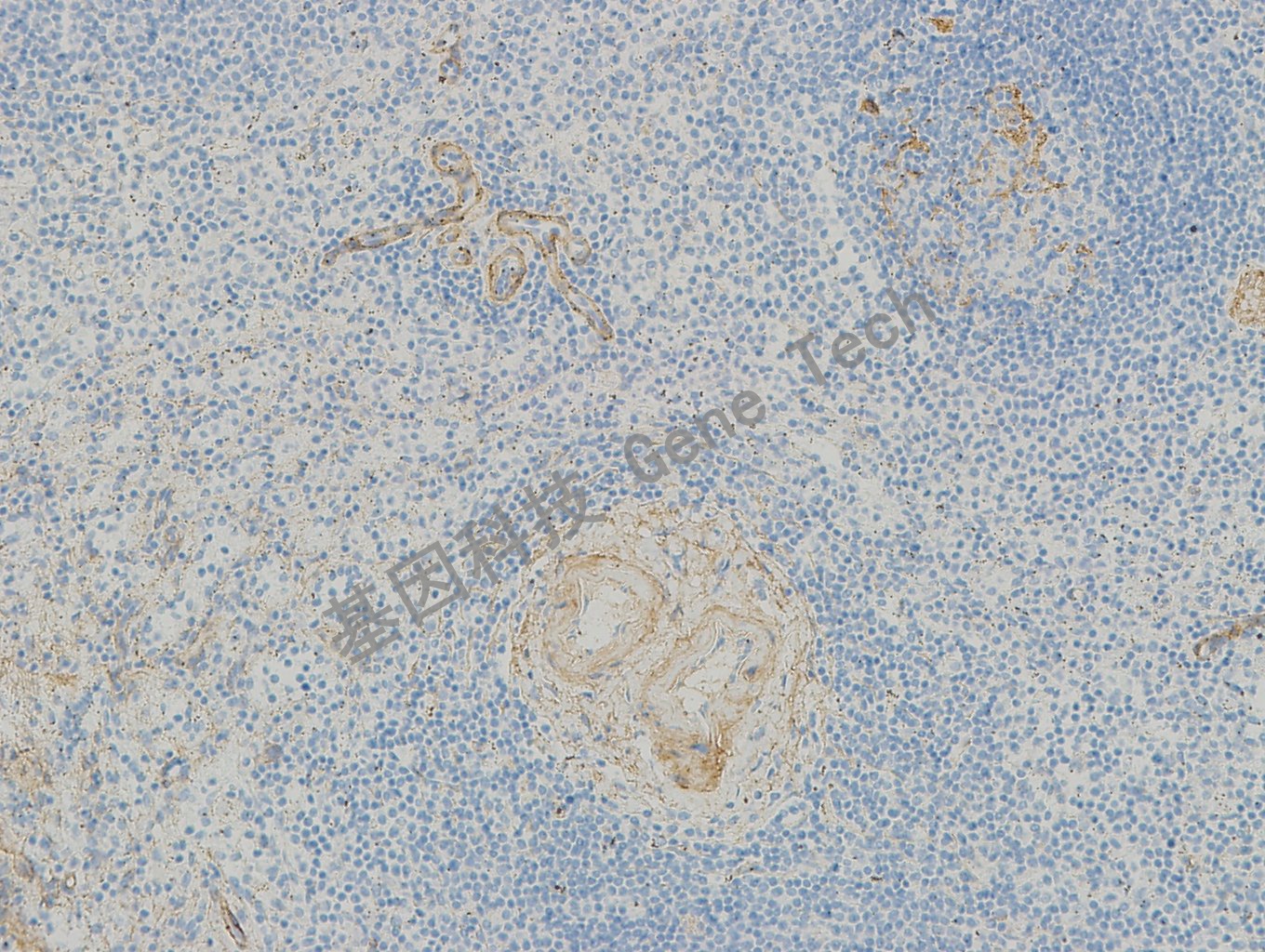 20190315-14 collagen IV BF6 脾脏-3_副本.jpg