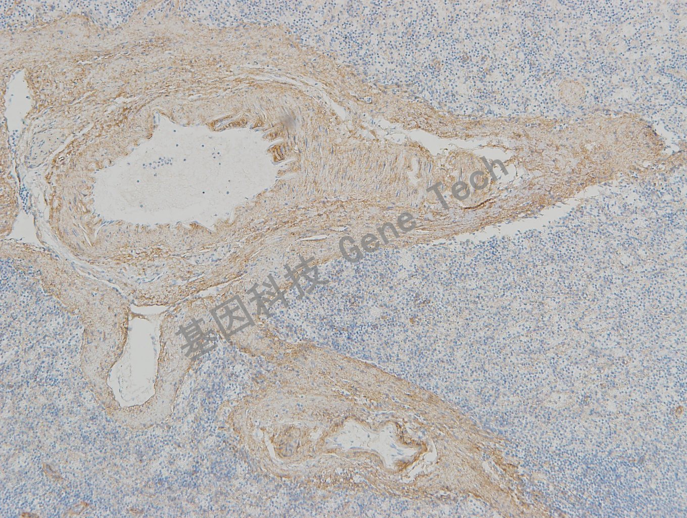 20190315-14 collagen IV BF6 脾脏-4_副本.jpg