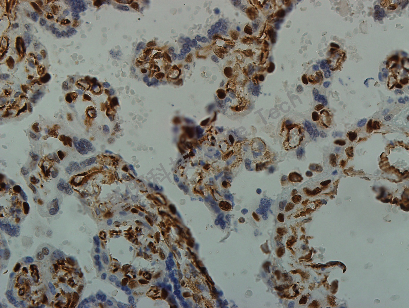 Cyclin E GT2231 40X 胎盘_副本.jpg