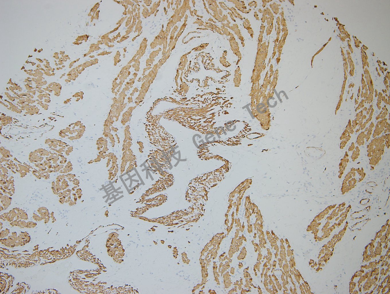 20180604-14 Desmin-T4 -3_副本.jpg