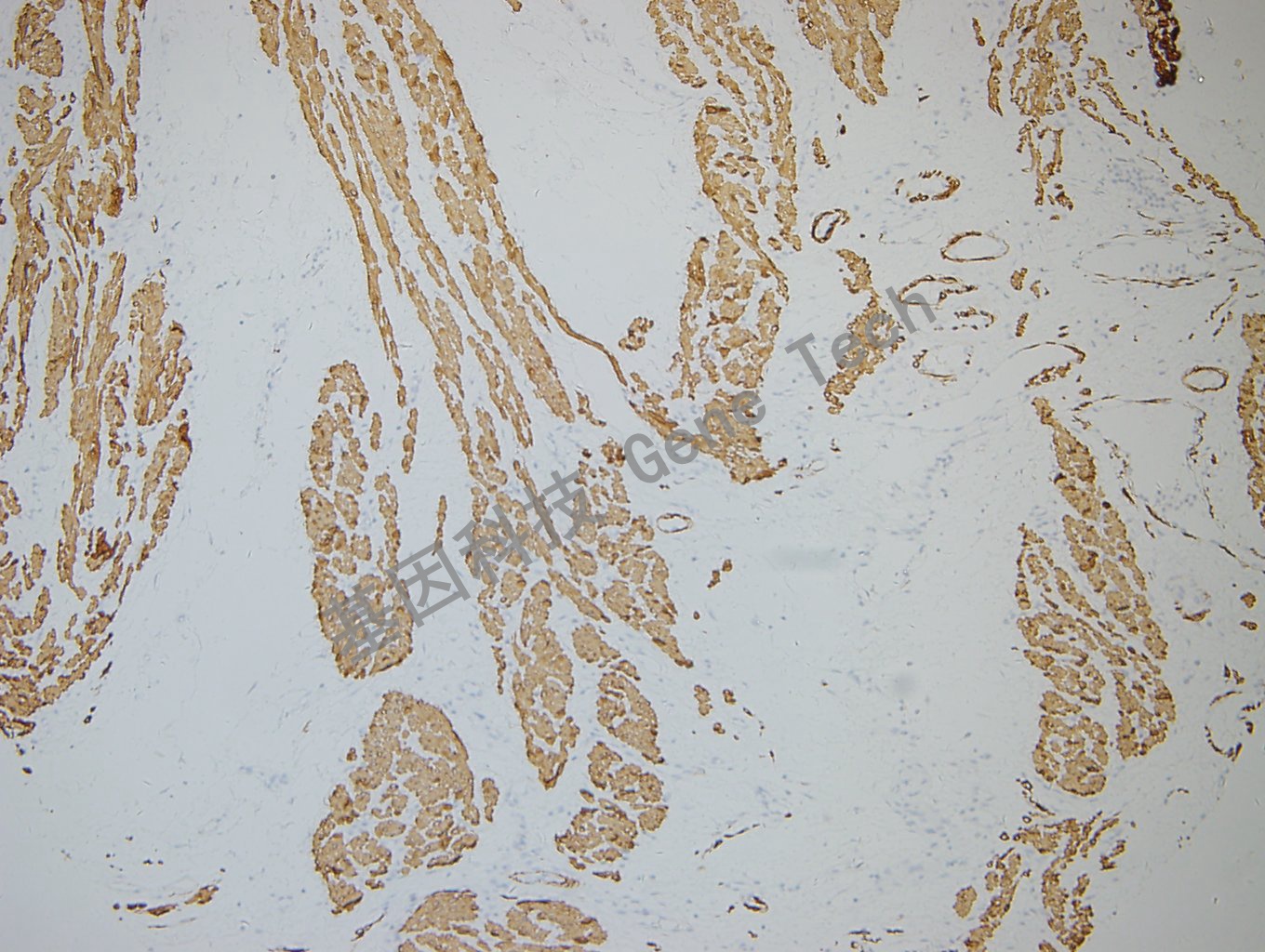 20180604-14 Desmin-T4 -4_副本.jpg