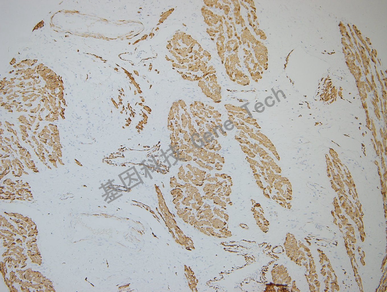 20180604-14 Desmin-T4 -5_副本.jpg