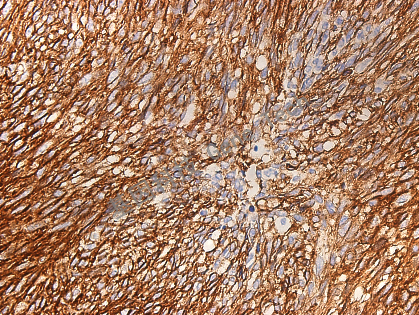 DOG-1 GT2054 GIST 40X_副本.jpg