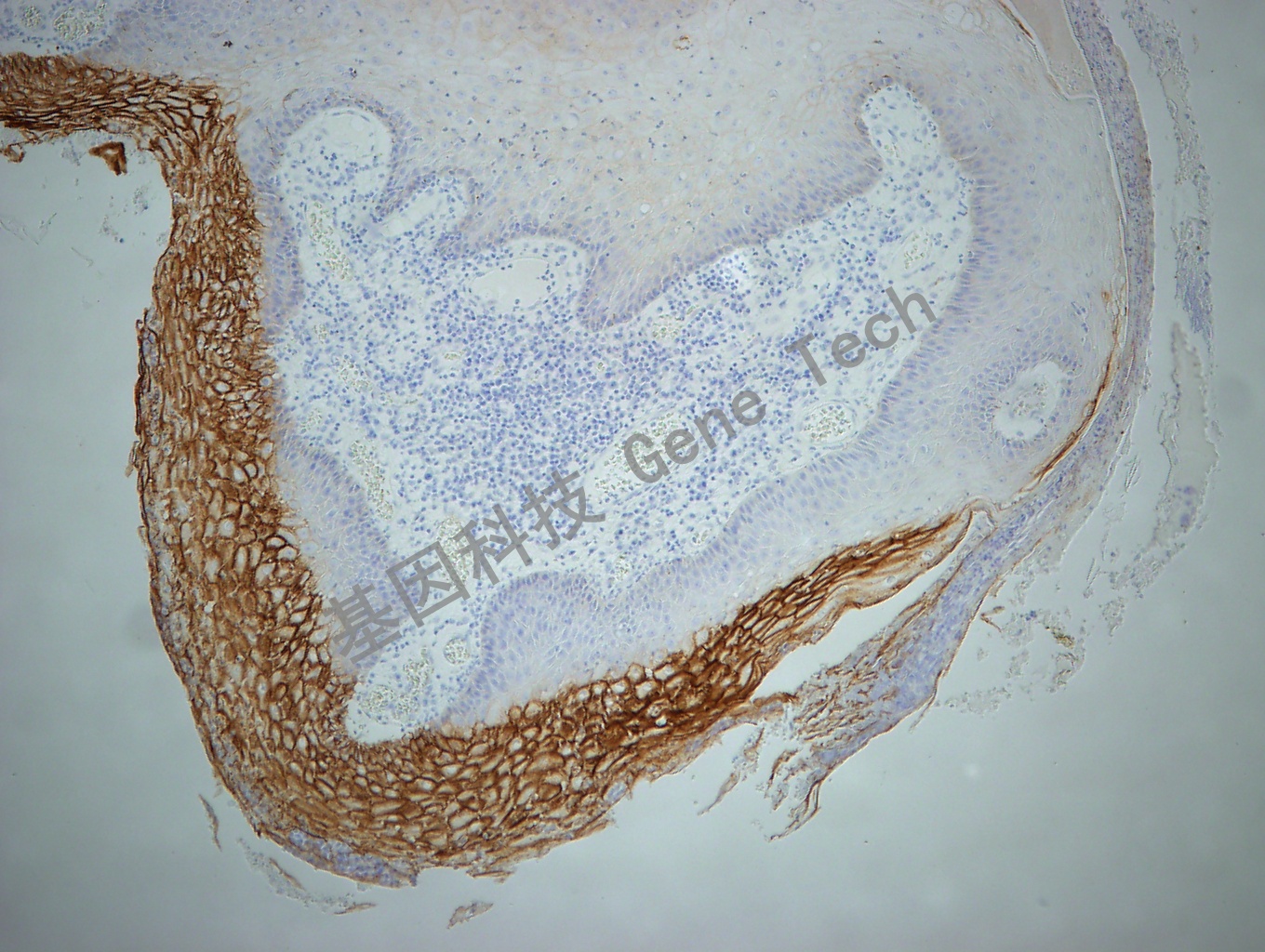 Desmoglein3 GT2256 10X 皮肤_副本.jpg