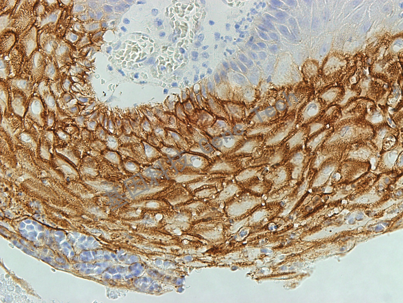 Desmoglein3 GT2256 40X 皮肤_副本.jpg