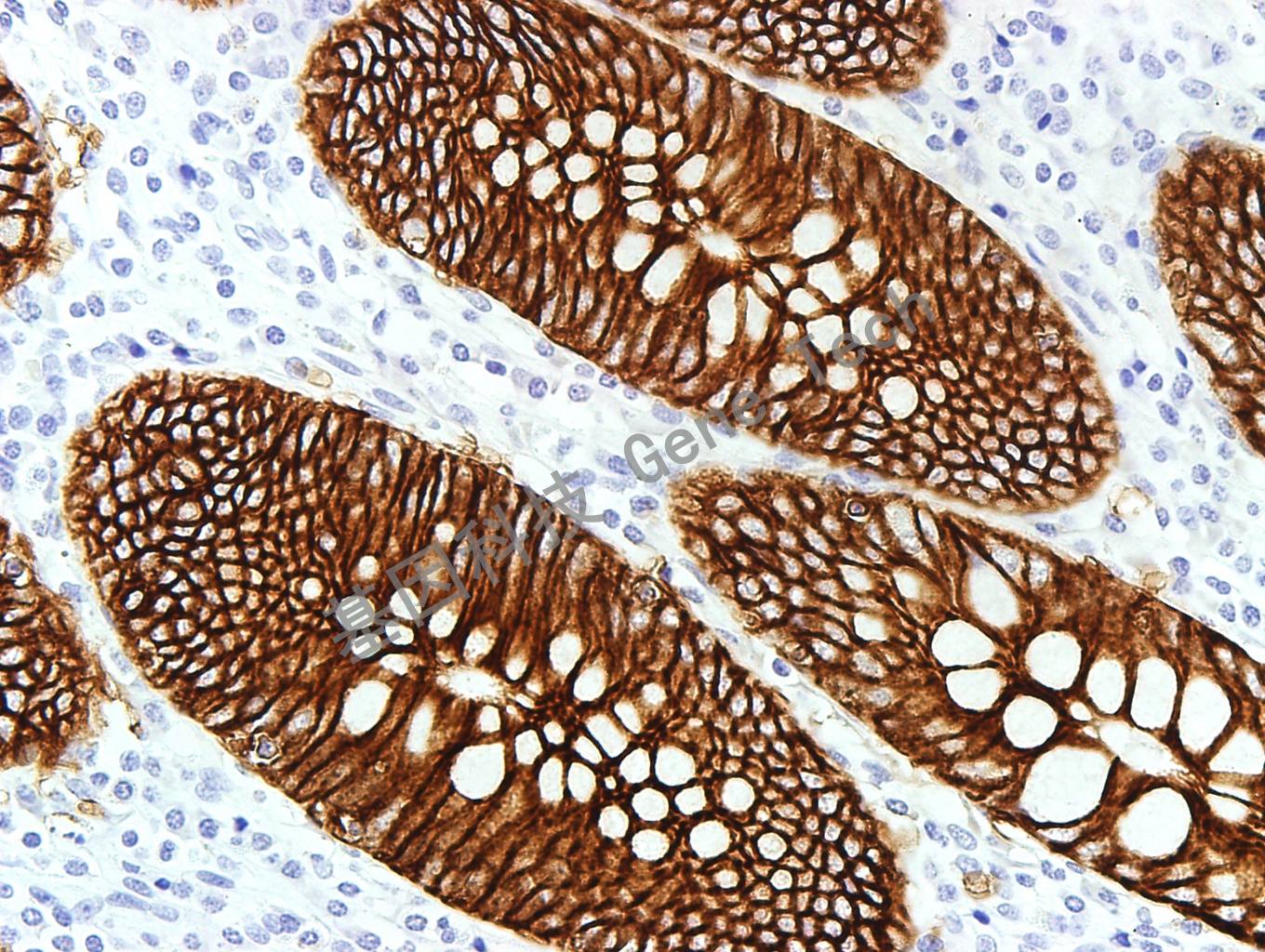 EA GM0804 阑尾40_副本.jpg