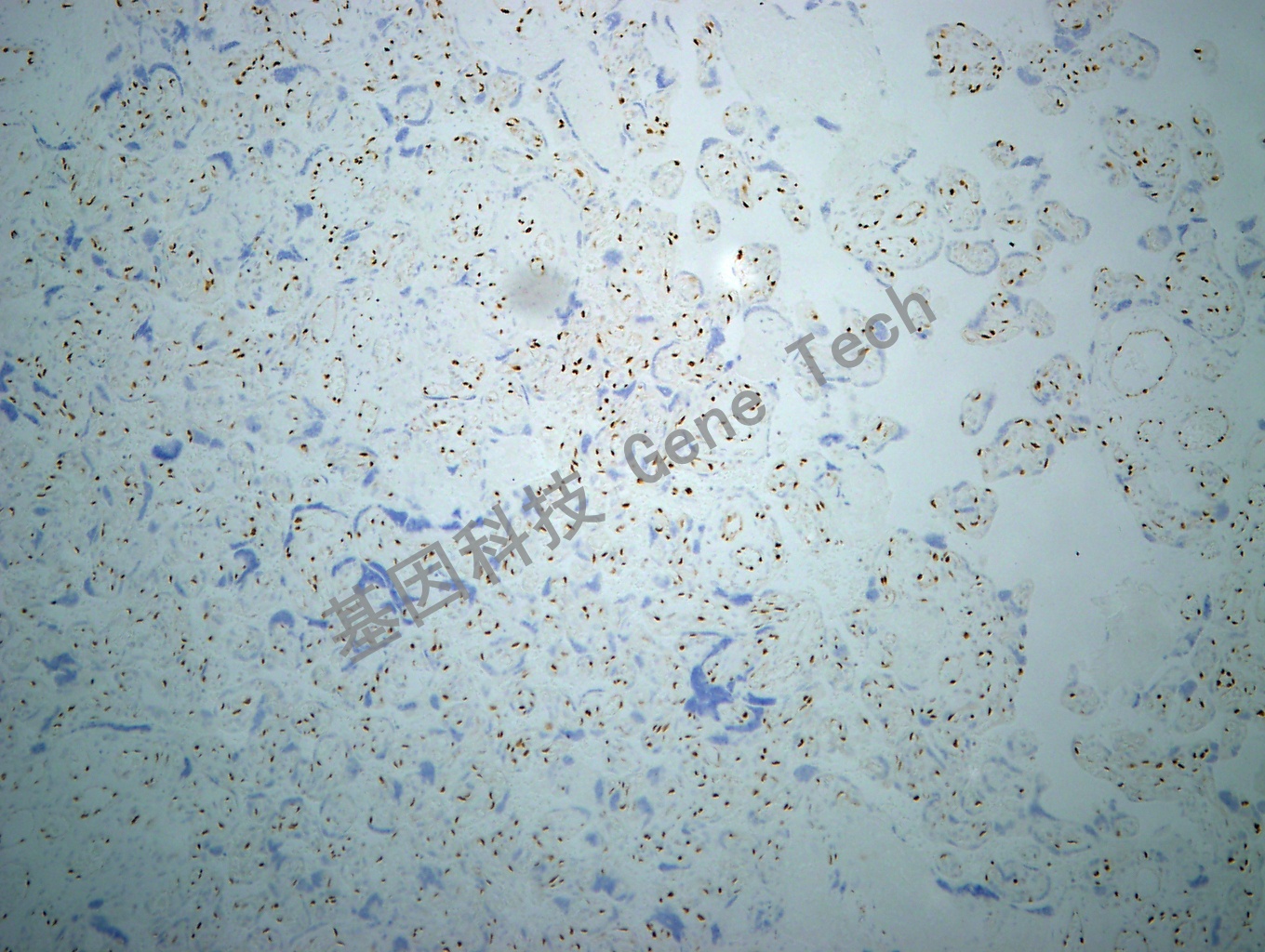 ERG GT2199 胎盘 10X_副本.jpg