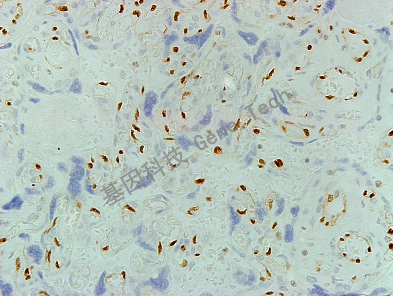 ERG GT2199 胎盘 40X_副本.jpg