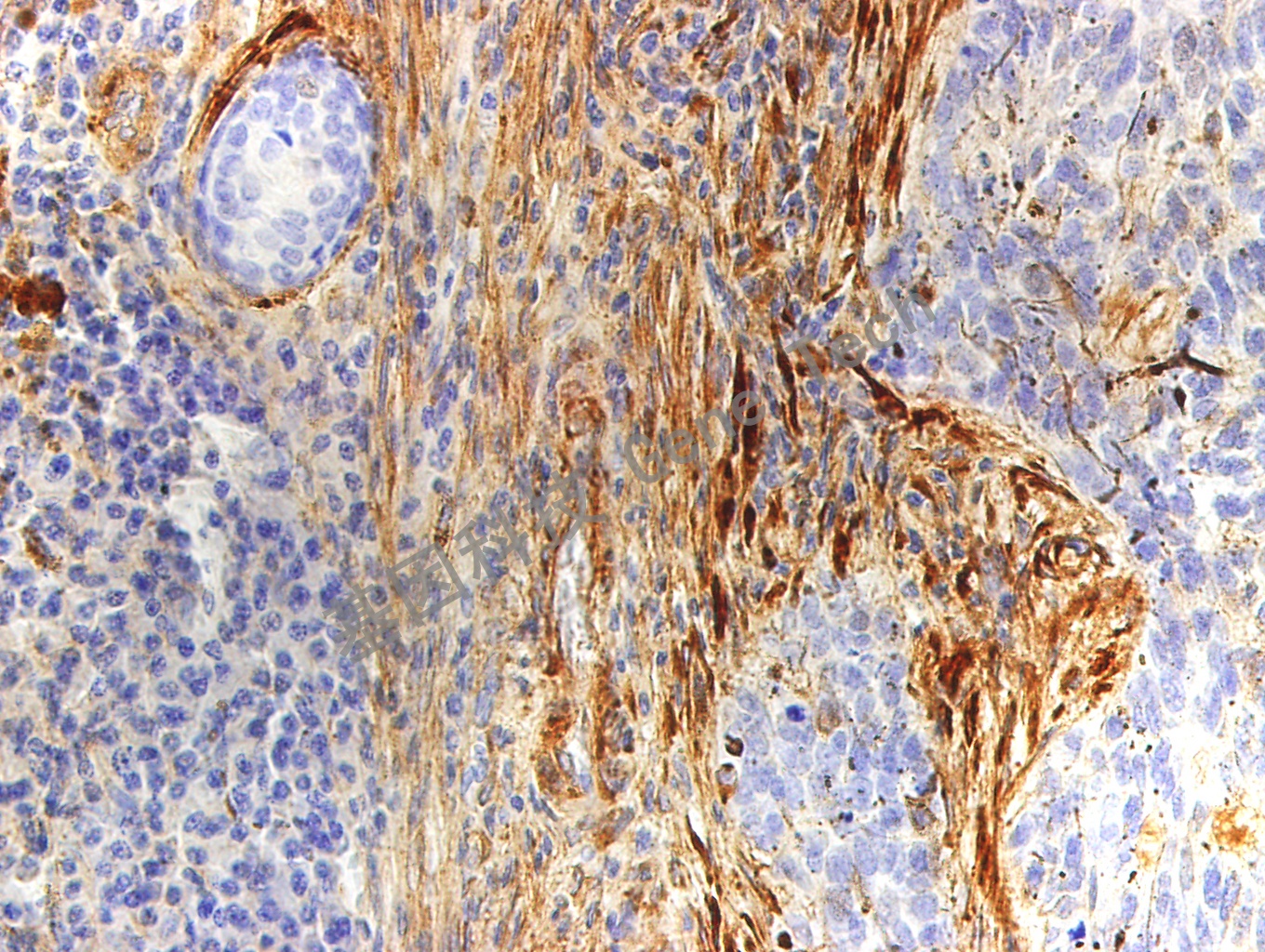 Fibronectin 鼠抗人 Fibronectin 抗体试剂（免疫组织化学）