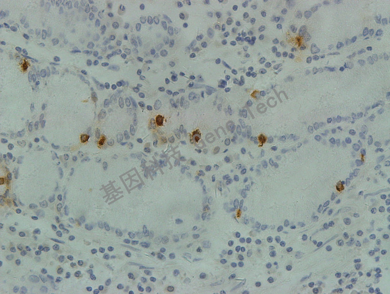 Gastrin GA0568 胃 40X_副本.jpg