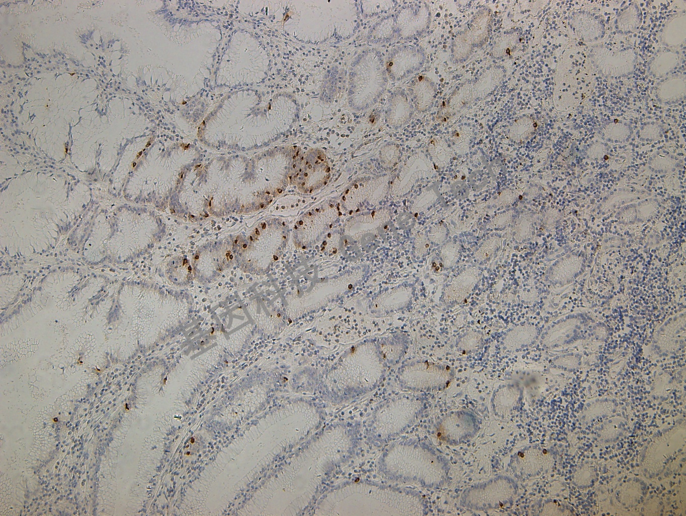 Gastrin GA0568 胃粘膜 胞浆_副本.jpg