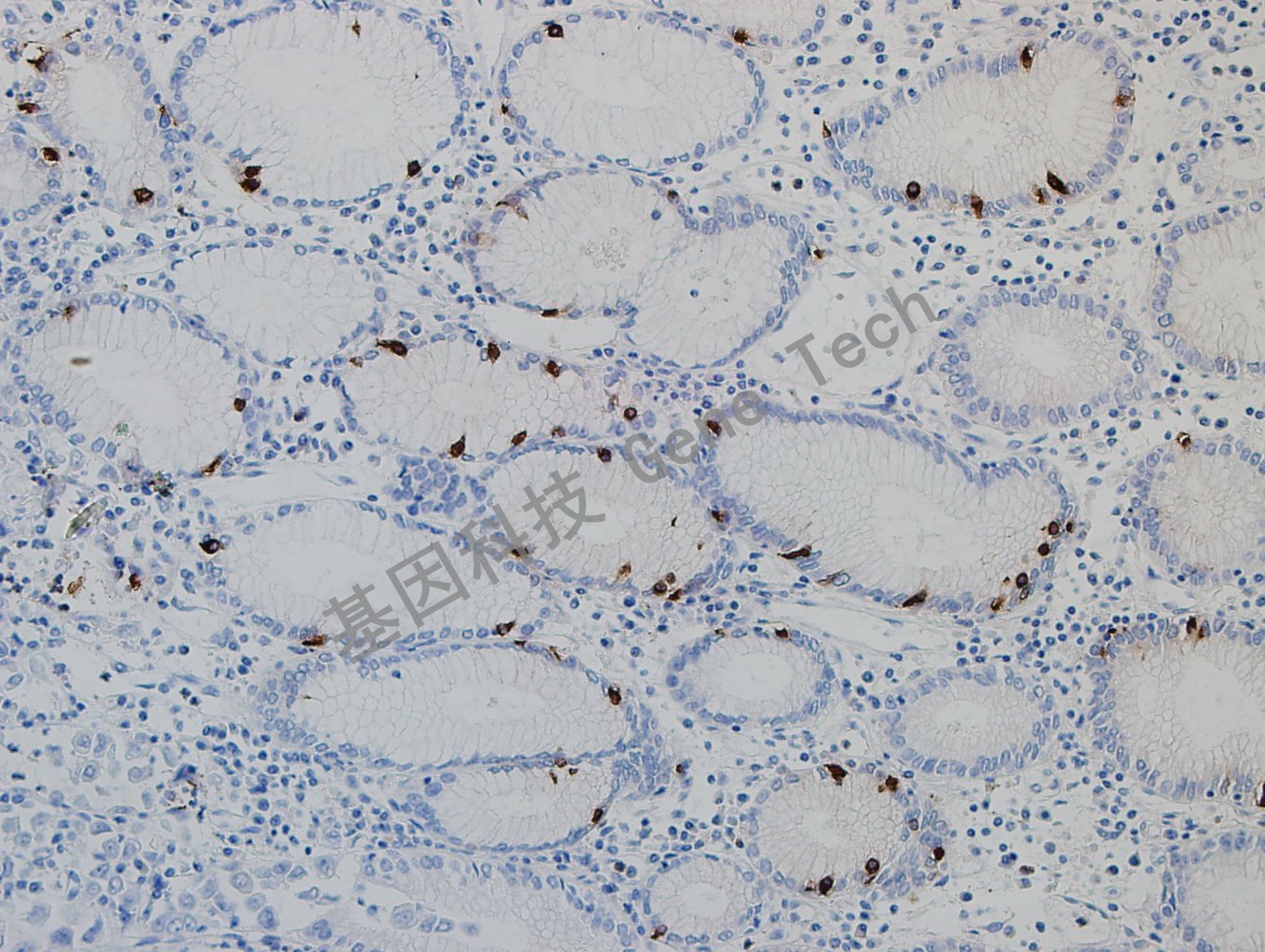 Gastrin 胃癌_副本.jpg