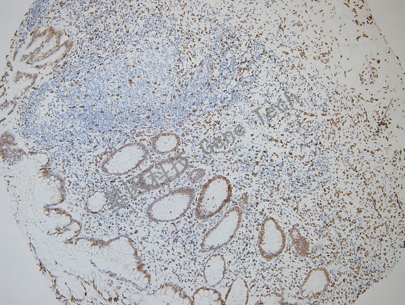 GATA2 阑尾_副本.jpg