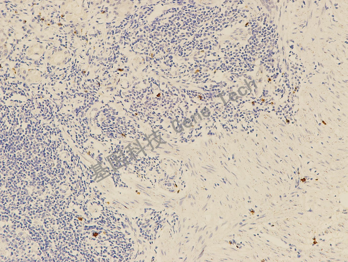 granzyme B GT2297 扁桃体_副本.jpg