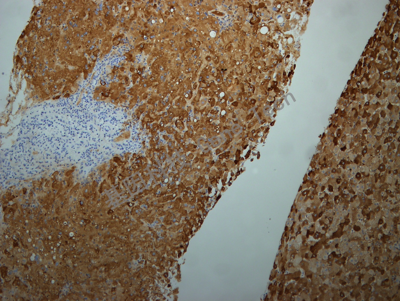 HBsAg GT2224 乙肝 10X_副本.jpg