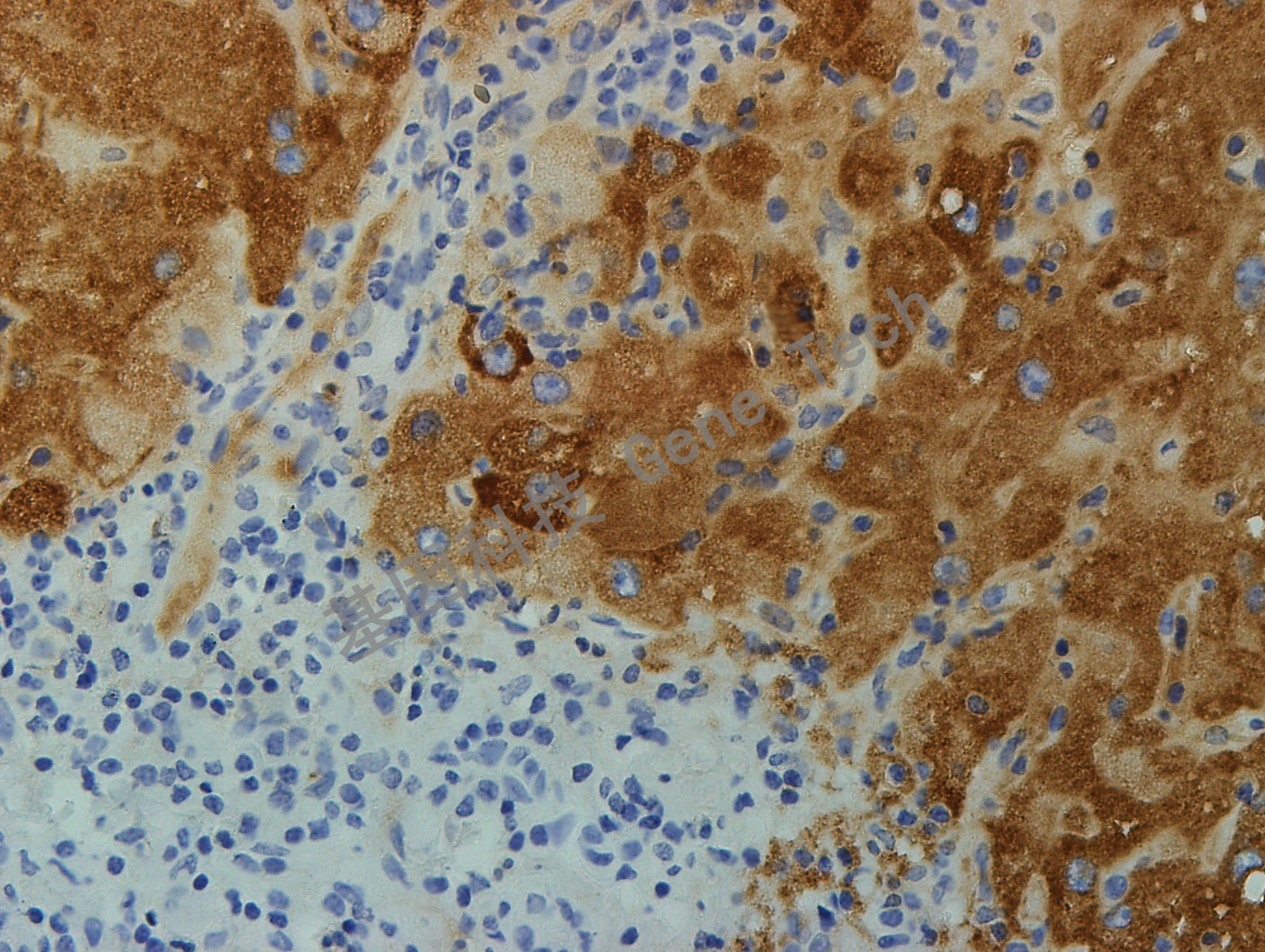 HBsAg GT2224 乙肝 40X_副本.jpg