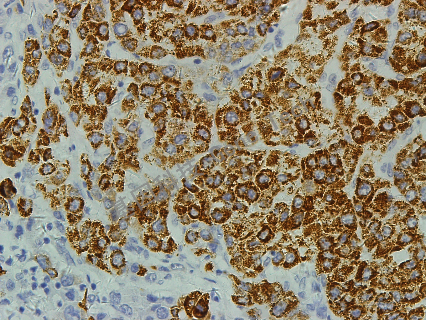 hepatocyte GM7158 肝癌 40X_副本.jpg